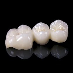 Layered Zirconia